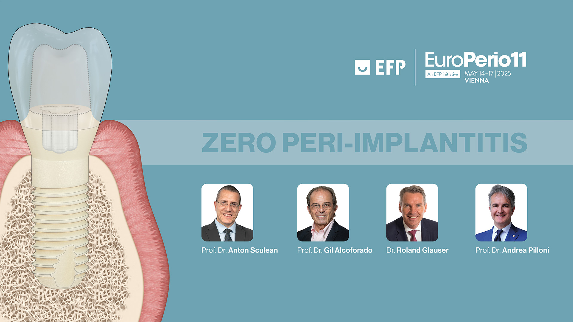 Peri Rio Zero Peri-Implantitis: First Prevention Concept Presented at ...