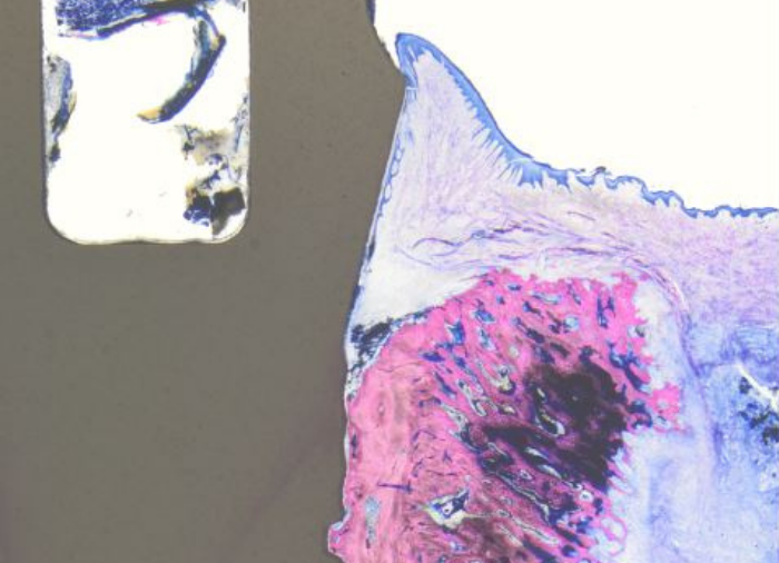 Histology of an inserted Patent™ Implant shows a particularly high degree of soft-tissue adaptation.