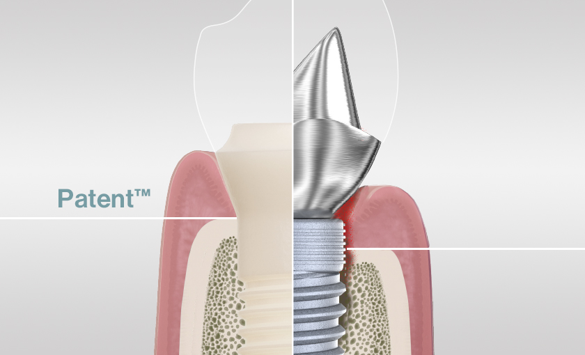 Soft Tissue Level Design