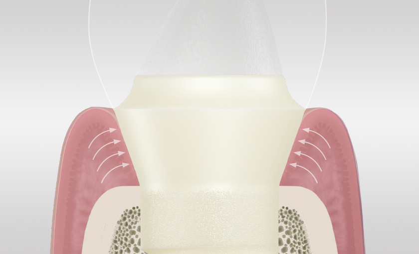 Soft Tissue Level Design