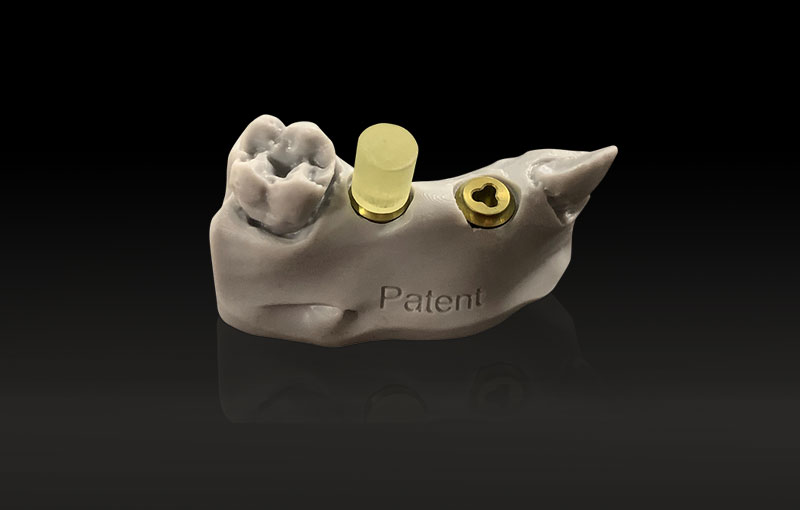Information for Dental Labs: The only healthy tooth replacement for life - The New Standard in Dental Implantology