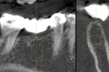 Clarico-3 Columns Style 2