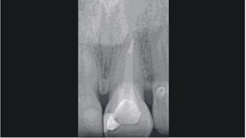 Clarico-3 Columns Style 2