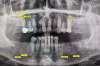 Clarico-3 Columns Style 2