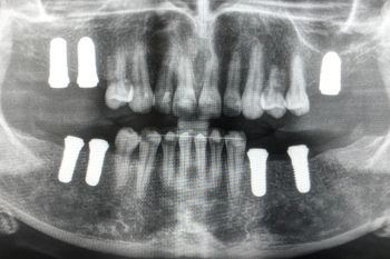 Clarico-3 Columns Style 2